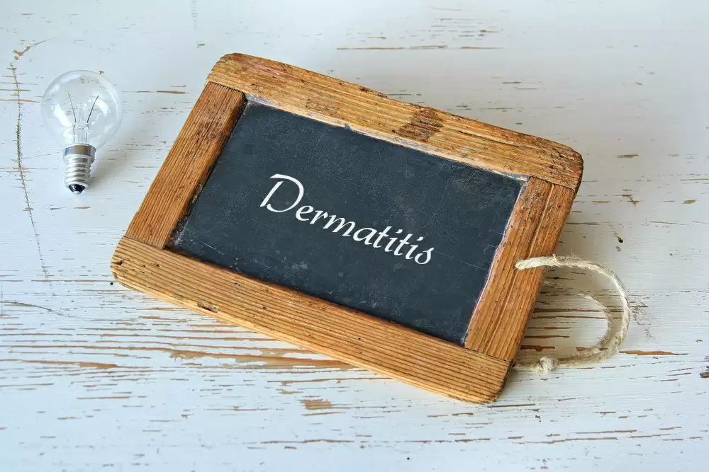 dermatitis_chalkboard--cc--hazma_butt.jp