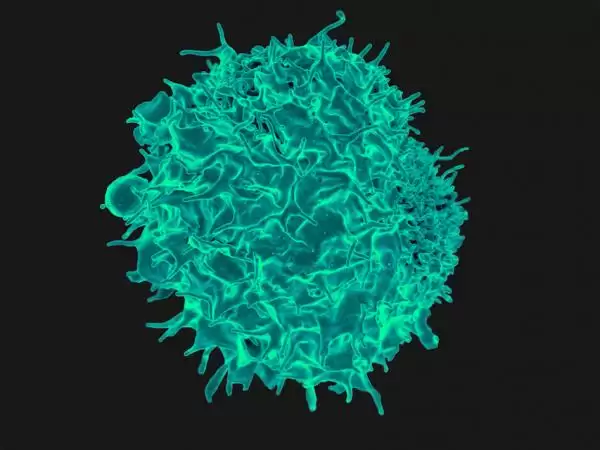 tlymphocyte--cc--niaid_thumb.webp