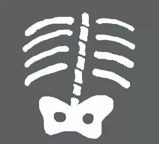 x-ray_skeleton-cc--fritz_park.webp