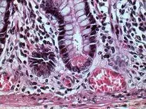 Goblet cells