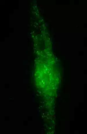 More information about "Possible Link Between TG6 Autoantibodies and Celiac Disease with Epilepsy and Cerebral Calcifications"