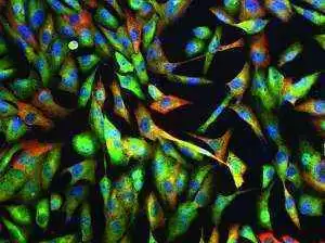Neurological Gluten Sensitivity Symptoms Linked to TG6 Autoantibodies - Photo: CC--GE Healthcare