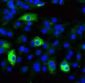 In this photo, hepatitis B attacks cells. Photo: CC--ajc1 In this photo, hepatitis B attacks cells. Photo: CC--ajc1