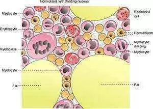 Can Celiac Disease Disappear After Allogeneic Bone Marrow Transplant?