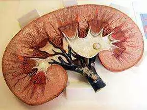 Photo: CC--National Museum of Health and Medicine Photo: CC--National Museum of Health and Medicine