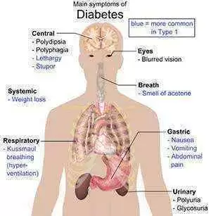 Image: Wikimedia Commons