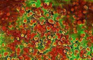 Photo of cardiovascular calcification--Wikimedia Commons--Sergio Bertazzo Photo of cardiovascular calcification--Wikimedia Commons--Sergio Bertazzo