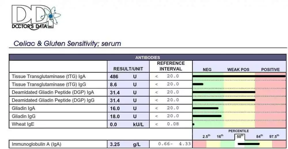 Pub Results.webp