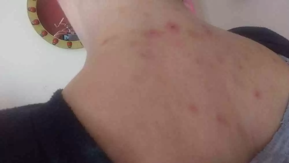14914916935111684351227.webp