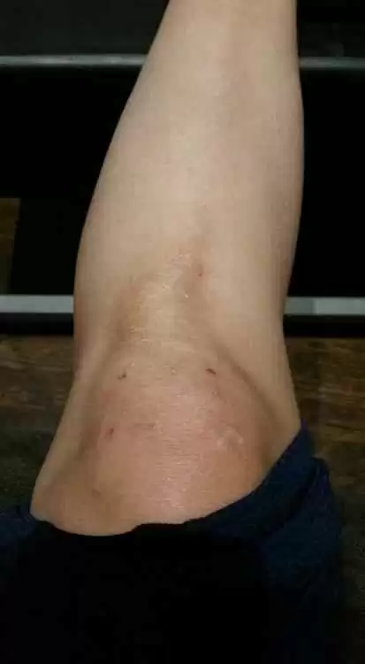 Celiac1.webp