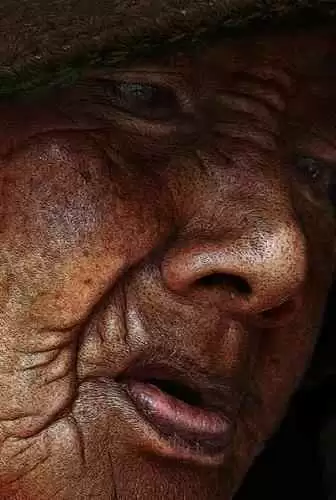 Nursing Home Care—The Great Challenge for the Celiac