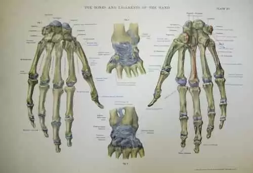 Can Carpal Spasm Be One of the First Signs of Celiac Disease? - Can carpal spasm be an early sign of celiac disease in some cases? Photo: CC--University of Liverpool Faculty Health Life Sciences