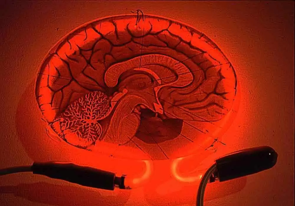 More information about "Are People with Celiac Disease More Likely to Have Cognitive Impairment At Diagnosis?"