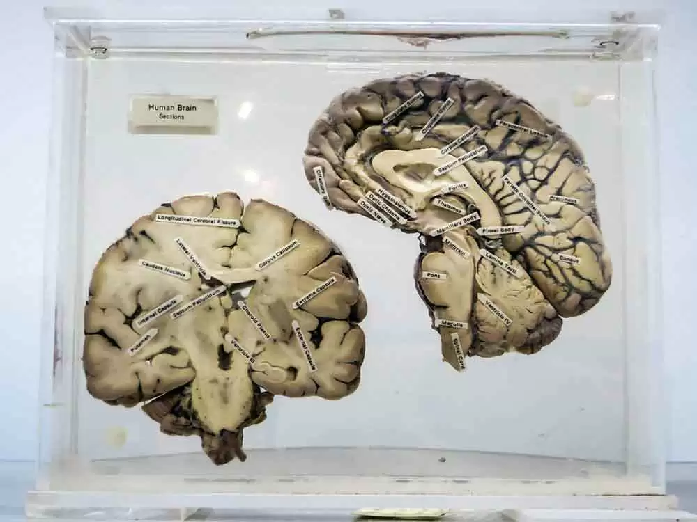 More information about "Common Neurologic Deficits in New Celiac Patients Linked With Autoimmunity to Transglutaminase 6"