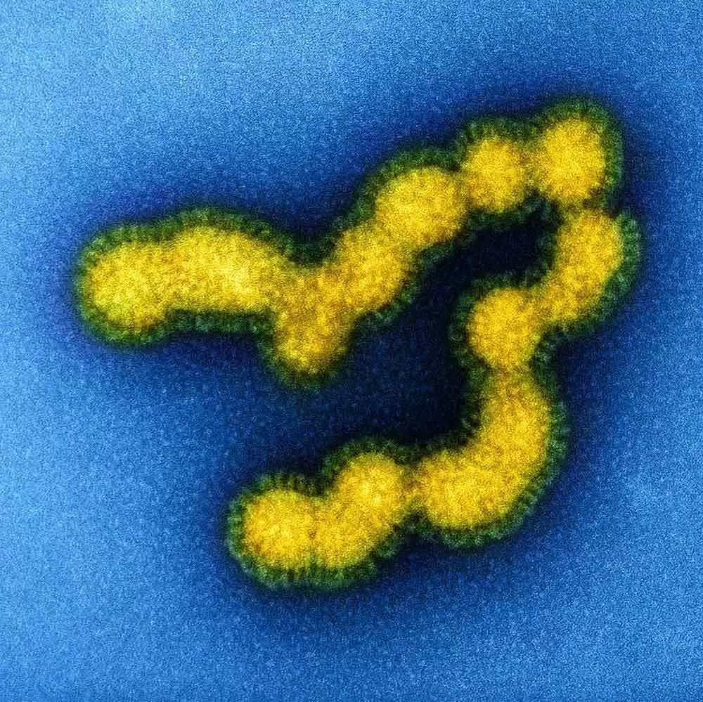 The Plagues of Pandora’s Box on Humankind