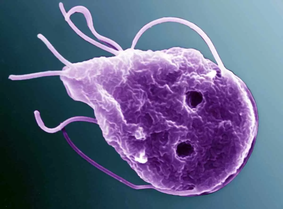 A Look at Giradia-related Elevation of Anti-transglutaminase and Anti-endomysium Antibodies - Image: CC BY 4.0--SEM of Giardia