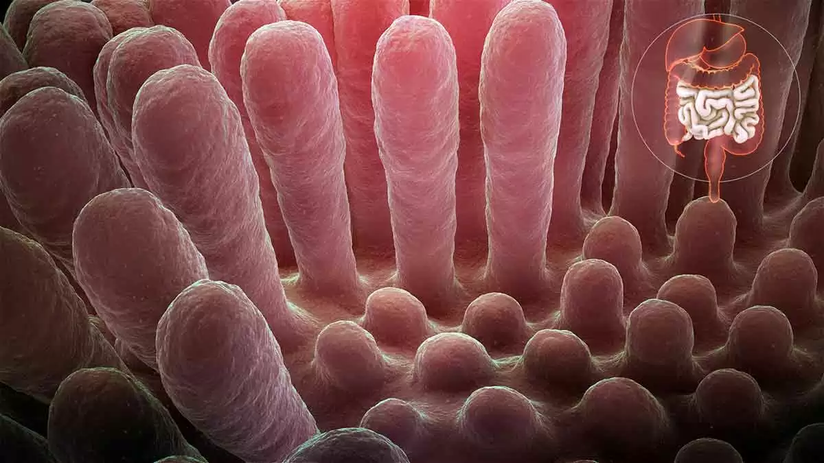 What Causes Villous Atrophy Besides Celiac Disease?