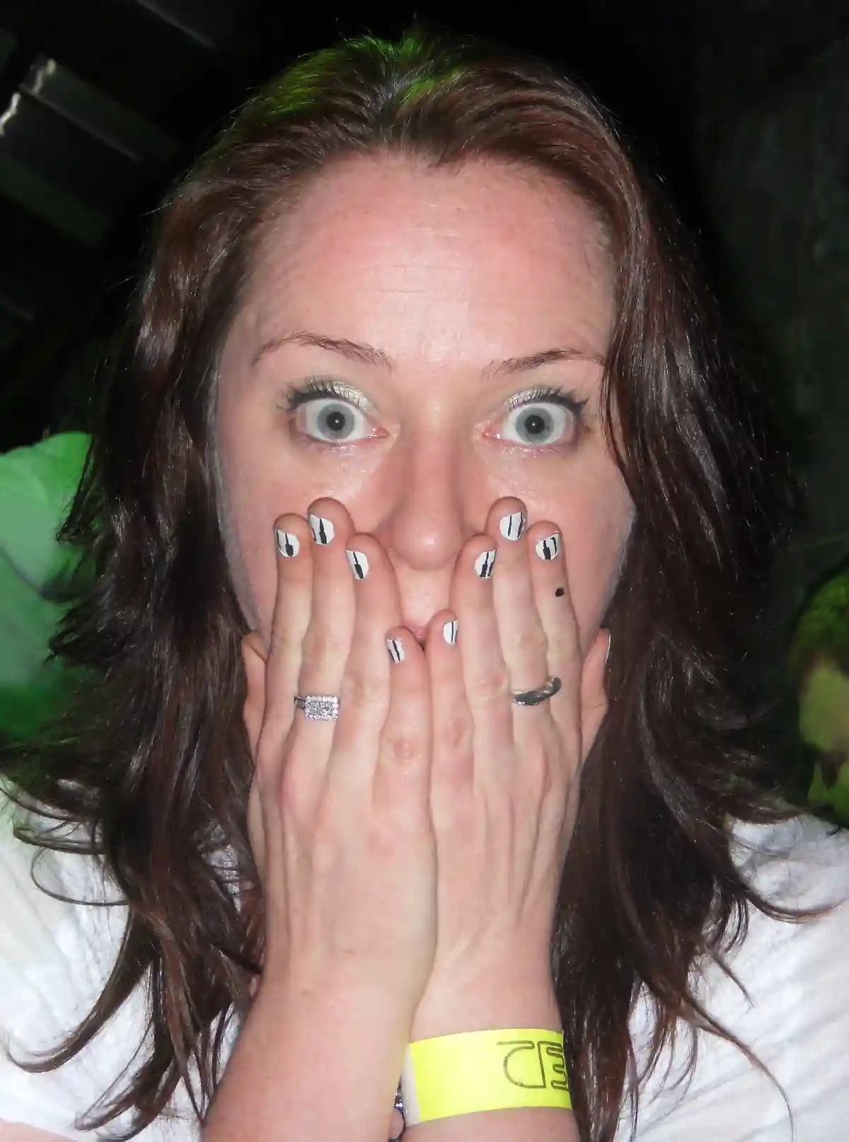 Just Diagnosed with Celiac Disease? Don't Panic, Your Health Will Soon Improve - shock! piano nail art by borispumps is licensed under CC BY-SA 2.0.