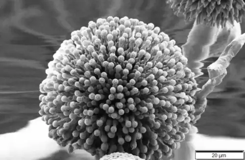 Will Commercially Available Gluten Digestive Enzymes Allow Those with Celiac Disease to Eat Wheat Crust Pizza? (+Video) - Aspergillus niger SEM by Mogana Das Murtey and Patchamuthu Ramasamy is licensed under CC BY-SA 3.0.++ Watch the Video ++