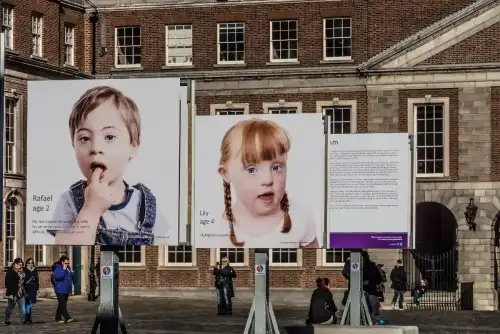 Celiac Disease in Children with Down Syndrome (+Video) - World Down Syndrome Day 2015- Here I Am Photo Exhibition Upper Courtyard Dublin Castle REF-102703 by infomatique is licensed under CC BY-SA 2.0.++ Watch the Video ++