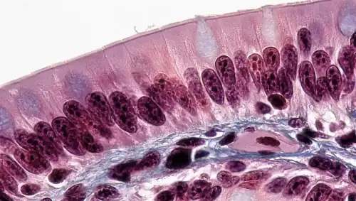 Immune Signaling and Stromal Support in Celiac Disease - Epithelial Tissues: Brush Border in Simple Columnar Epithelium by bccoer is marked with CC0 1.0.