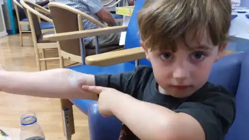 When "Low" Celiac Blood Tests Still Point to Celiac Disease (+Video) - Joe being very brave ahead of his blood test by Kradlum is licensed under CC BY 2.0.++ Watch the Video ++