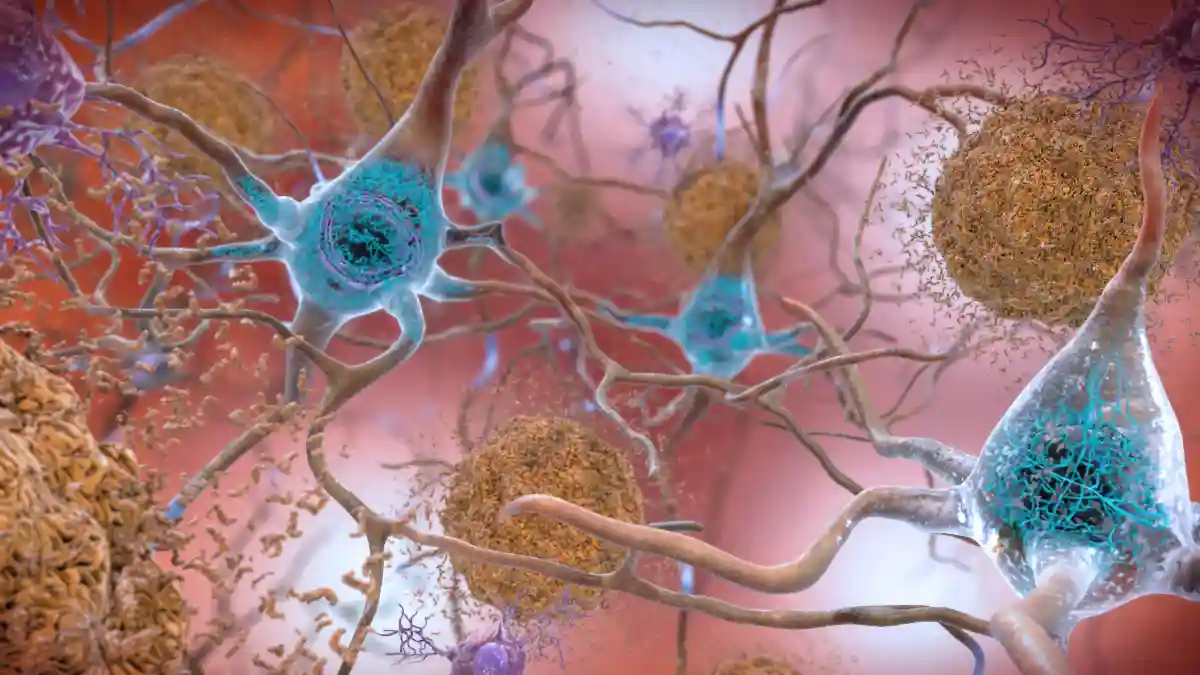 More information about "Could Gluten and Alzheimer’s Be Linked? New Research Uncovers Surprising Protein Parallels (+Video)"