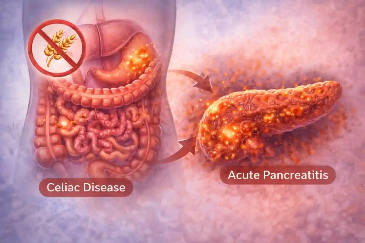 More information about "New Study Finds Higher Pancreatitis Risk in People with Celiac Disease (+Video)"