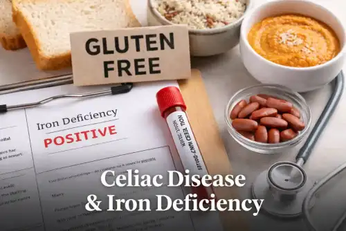 Why Iron Deficiency Is So Common in Celiac Disease—Even After Going Gluten-Free (+Video) - Image: Celiac.com ++ Watch the Video ++